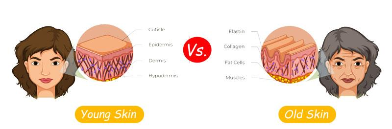 Figure 3 Young Skin Vs. Old Skin due to Collagen deficiency